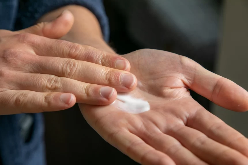 Najbolje prirodne kreme za ruke koje možeš napraviti sama
